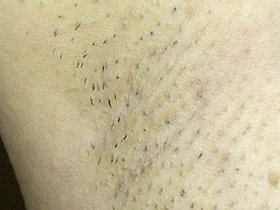 300人のわき　サンプル画像10